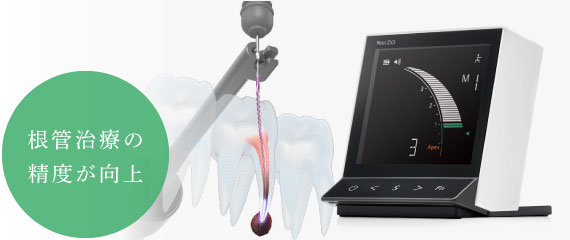 根管治療の精度が向上