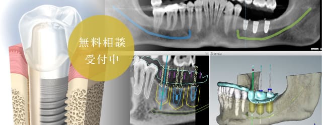 無料相談受付中