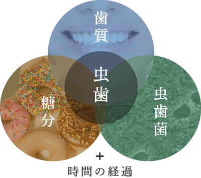 虫歯 歯質 虫歯菌 糖分