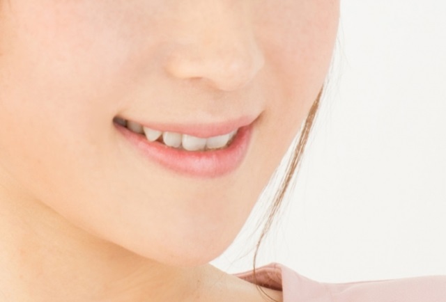 歯並びの悪さによって起こる体への悪影響